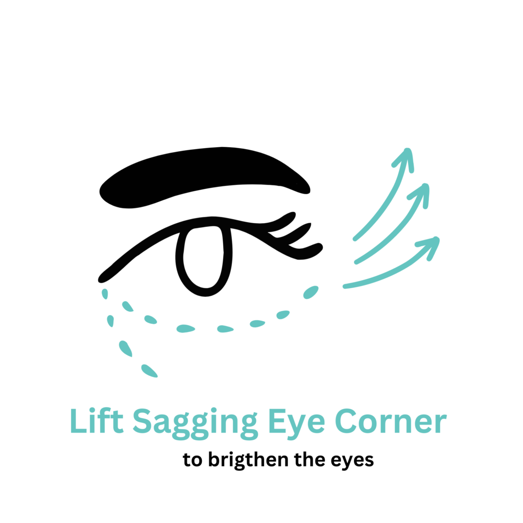 lift sagging eye